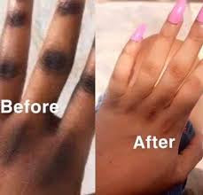 Clinic Clear Ultimate Whitening Set (7 PACK) Clinic Clear