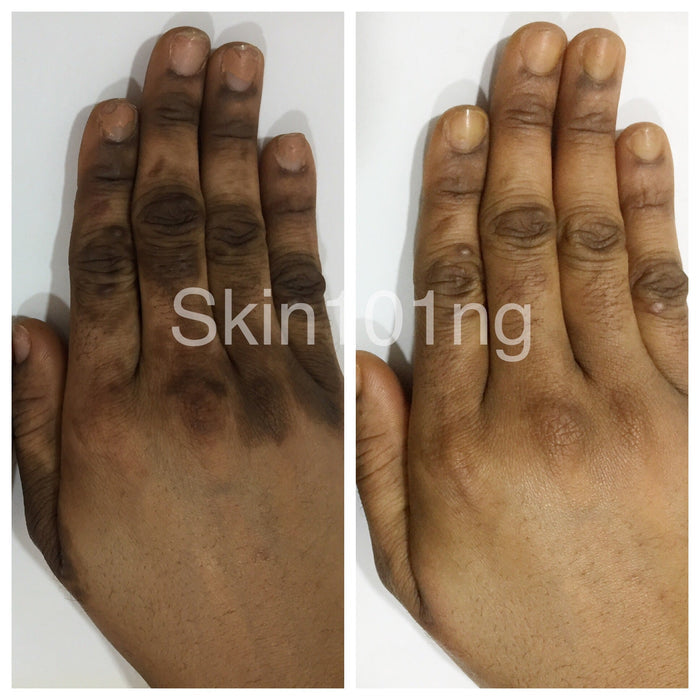 Clinic Clear Ultimate Whitening Set (7 PACK) Clinic Clear