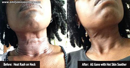 before and after