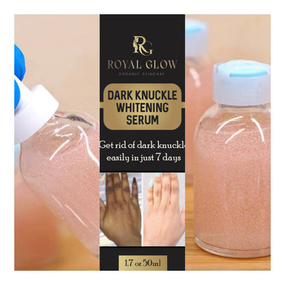 Fast Super Lightening Solution Dark Knuckle Remover RoyalGlow Organics
